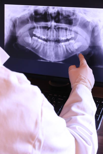 Best Emergency Dental Extractions in Bostonia, CA